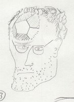 Self-portrait with dodecahedral bug bite